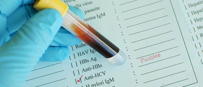 Почему бывает анализ на гепатит сомнительный thumbnail