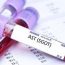 Высокие показатели АЛТ и АСТ при гепатите